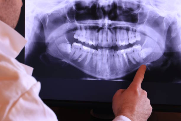 Best Emergency Treatment for Dental Infections or Abscesses in Ivanhoe, TX