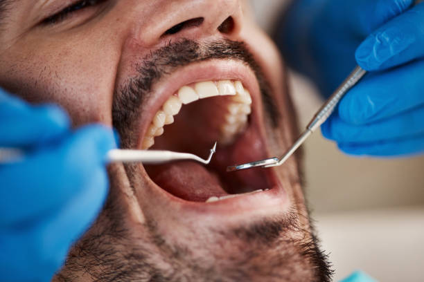 Best Urgent Care for Lost Fillings or Crowns in Ivanhoe, TX